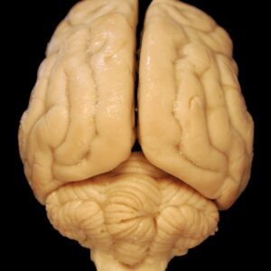 Cranial-Sacral Therapy 18-CEU Online Course Bundle